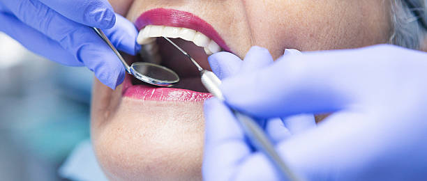 Best Emergency Dental Care for Broken or Chipped Teeth in Elgin, SC